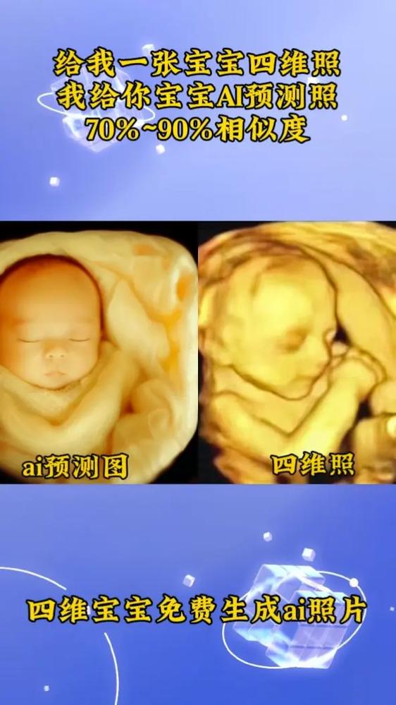 胎儿四维照片ai生成还原软件缩略图