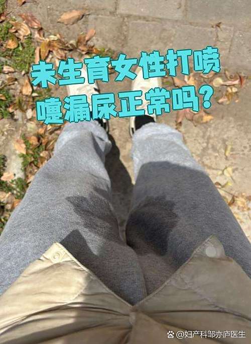 漏尿是什么症状图标