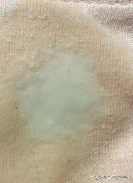 男性尿完尿后有白色粘稠液体流出图标