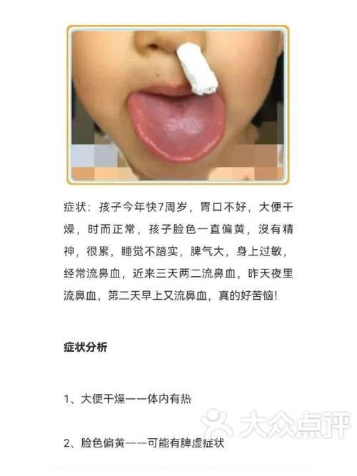 小孩流鼻血可以用云南白药粉吗