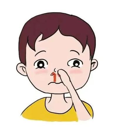 流鼻血了怎么办才能快速止血缩略图