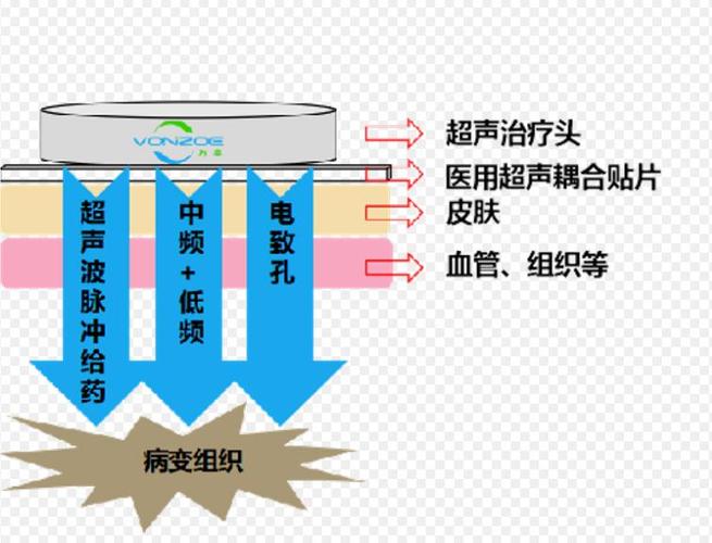 超声波导入仪的功效与原理