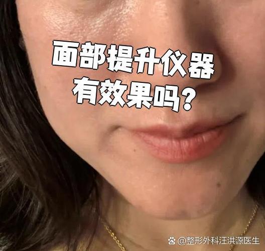 面部提升仪器管用吗