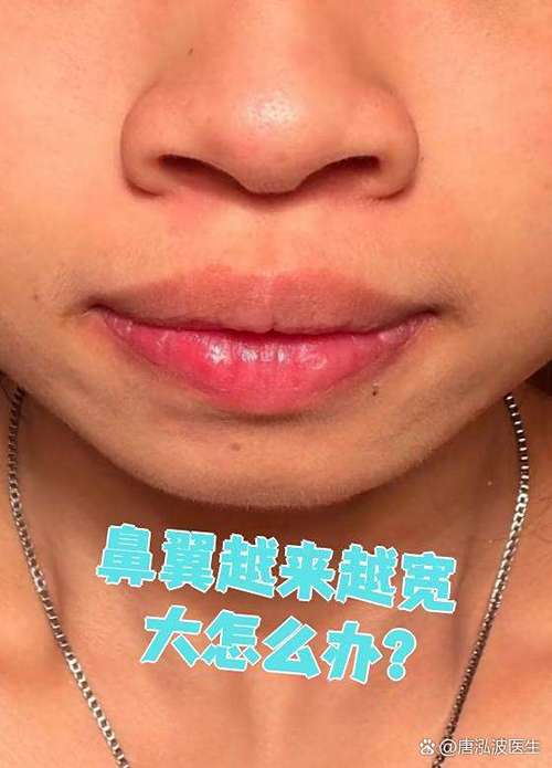 抠鼻子会让鼻翼变宽吗缩略图