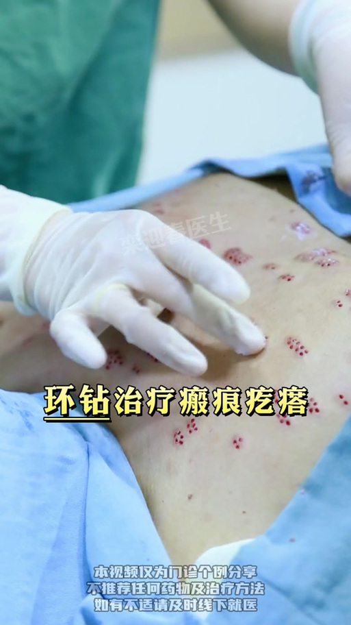 疤痕修复的最佳方法