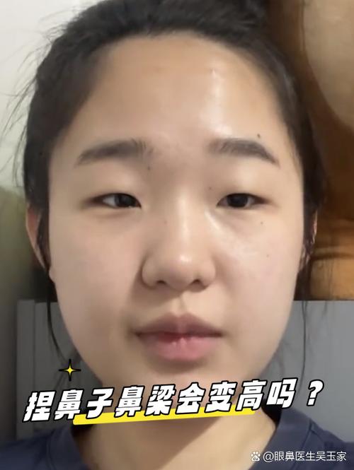 成年后经常捏鼻梁会变高吗