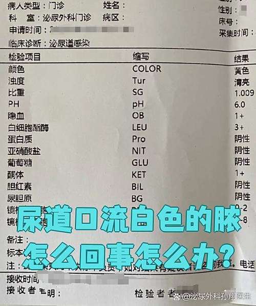 尿道口有白色脓液流出请问什么原因图标