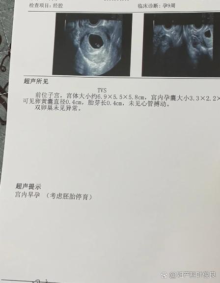 孕囊2.5×1.4是怀孕多久了图标