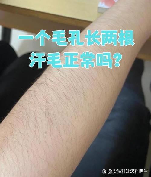 一个毛囊两根毛