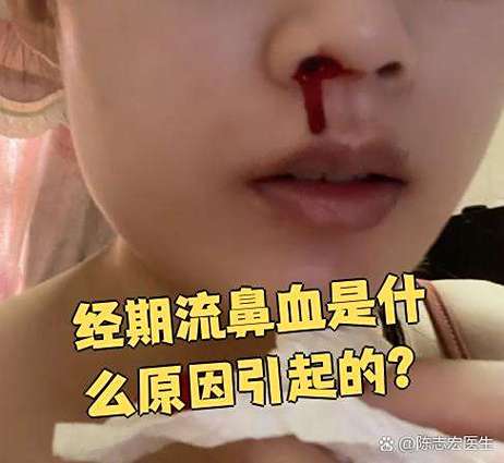 生理期突然流鼻血警惕