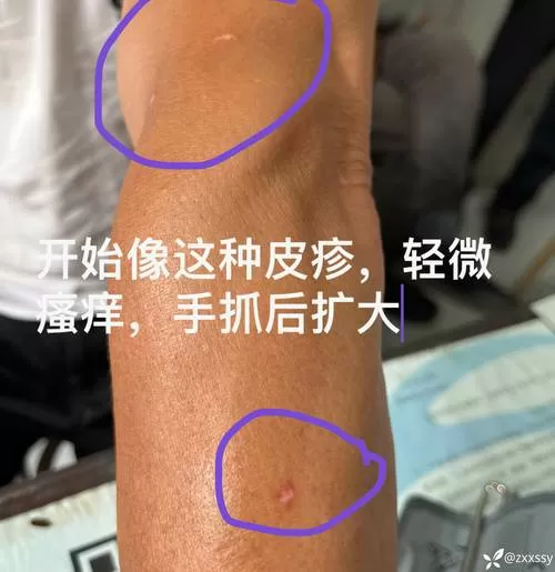 百度扫一扫识别皮肤病在哪里识别缩略图