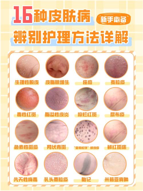 百度扫一扫识别皮肤病完整版